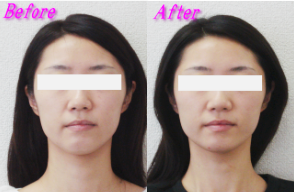 川口様のビフォーアフター