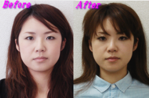 池上様のビフォーアフター