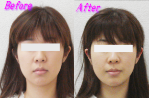 相川様のビフォーアフター