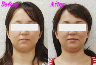 浅倉さん体験談