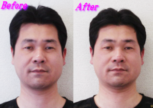 藤原さん施術事例