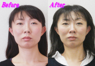 浜野さん体験談