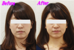 林様のビフォーアフター