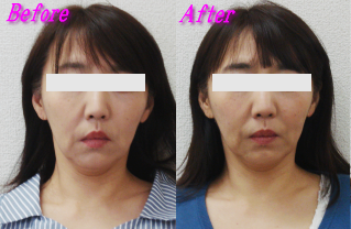 一条さん施術事例