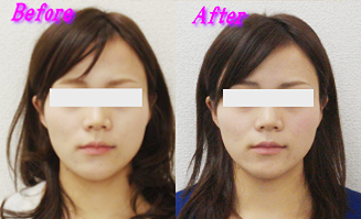 加藤さん体験談