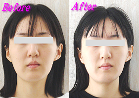 香坂さん体験談