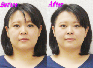 工藤さん施術事例