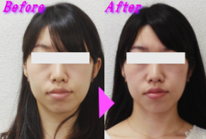 牧原様のビフォーアフター