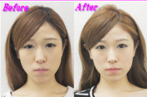 中山様のビフォーアフター