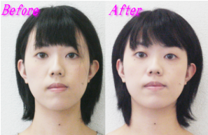 成田様のビフォーアフター