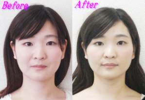 杉崎様のビフォーアフター