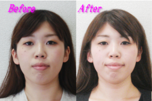 塚原様のビフォーアフター