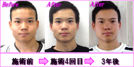 林田さん 3年間の経過写真