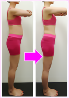 骨格矯正の変化