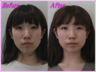 札幌の小顔専門美容整体
