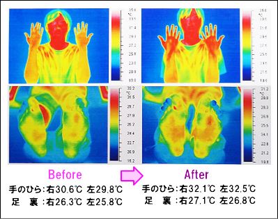 体温変化での自律神経調整作用の研究データ：サーモグラフィー撮影画像
TN健康科学研究所