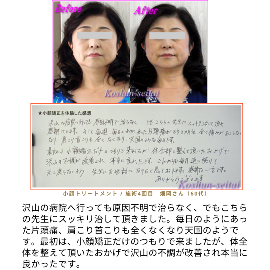 小顔矯正口コミ