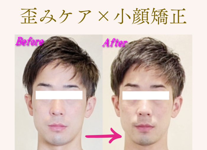メンズにもおすすめ！札幌で体の歪みを整えてシャープな小顔を手に入れる小顔専門美容整体